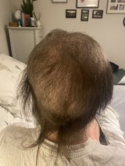 Cancer Support Thread 96: It’s nearly Christmas - get the sprouts on.