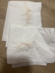 9 dpo, implantation bleeding?