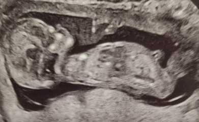 Is this the nub? Where do I look?