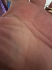 Strange thing with my hands!