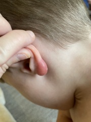 Swelling on ds4’s ear — any ideas?
