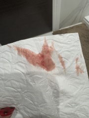 Bleeding in 7 weeks