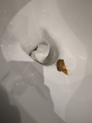 Mucus in child's stool