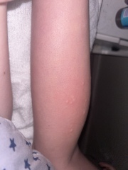 Bed bugs?!