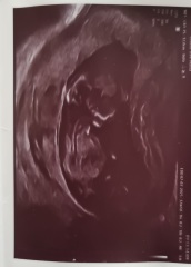 Gender Nub theory, guesses please! 12+5