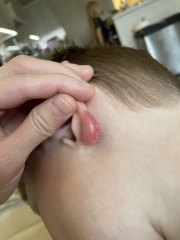 Swelling on ds4’s ear — any ideas?