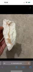 Is this implantation?
