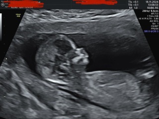 Nub and skull-theorie!What do you think?Was your prediction correct? Experiences?