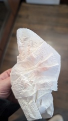 (TMI pic!) Implantation bleeding??? Or early AF