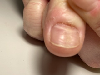What is wrong with my thumbnail?
