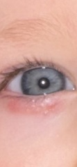 Baby eye