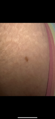 Moles