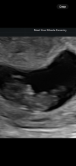 Boy or girl predictions? Just for fun :)