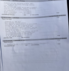 Immune/NK cells pred thread #32