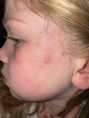 What is this!? Spot on face