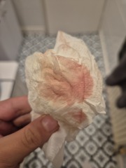 What is this? 🤦🏼‍♀️