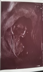 Gender Nub theory, guesses please! 12+5