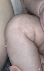 Baby rash!! Any ideas???