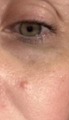 Is this a cyst?