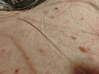 What is this rash? Any ideas what could have caused it?