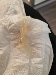 35 weeks 3 days loosing plug? PHOTOS TMI