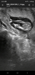 Boy or girl