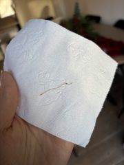 Worms in stool???
