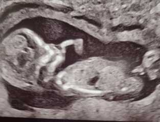 Is this the nub? Where do I look?