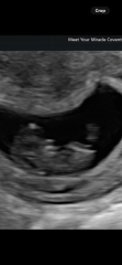 Boy or girl predictions? Just for fun :)