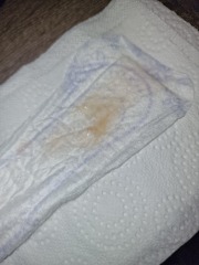 35 weeks 3 days loosing plug? PHOTOS TMI