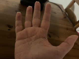 ALS/Hand Atrophy
