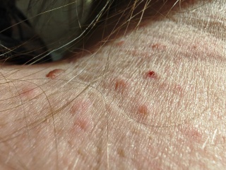 What is this rash? Any ideas what could have caused it?