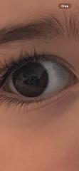 Can anyone put my worried mind at ease? What are these dark spots in my toddler’s eye?