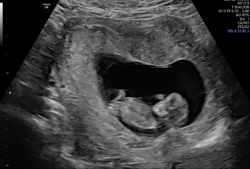 Any Guesses on scan photo?
