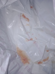 Pink sick, blood or berries? pictures.