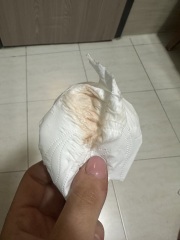 Implantation bleeding? (Warning-pic attached