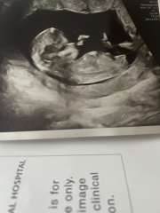 12 week scan gender predictions?