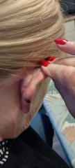 ENT / swollen ear / can’t get a diagnosis :-/