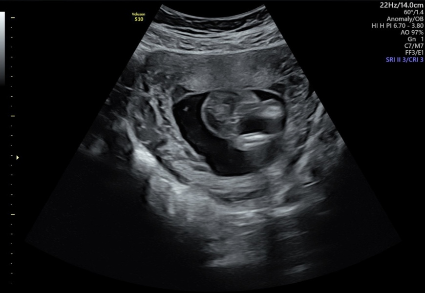 Any Sonographers out there?