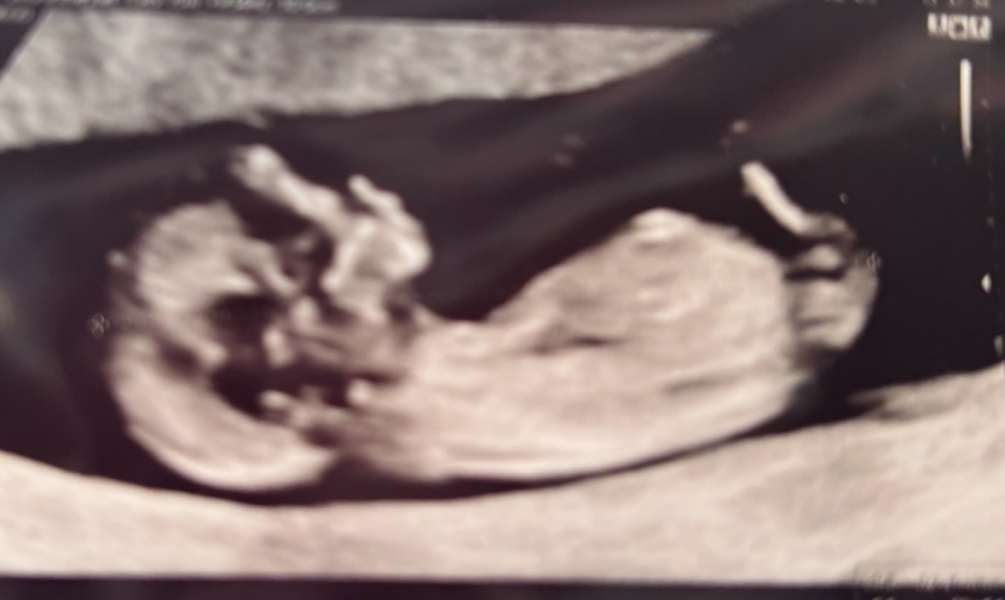 Boy or Girl