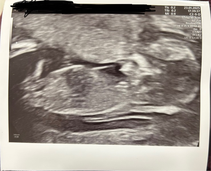 Anyone doing FET/IVF in November 2024?✨