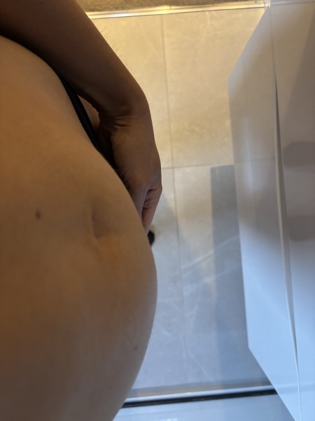 Embarrassing problem (bowel related)