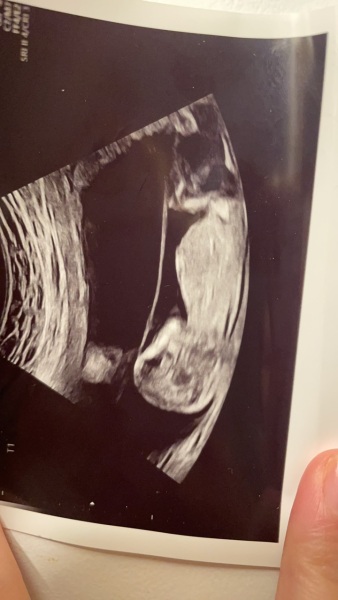 Nub theory for my twins