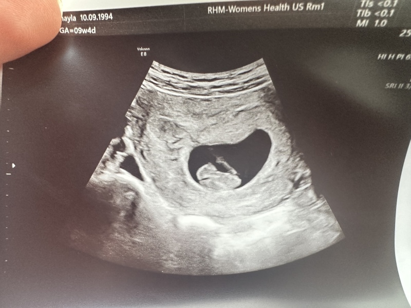 Does this 9 week scan look ok?
