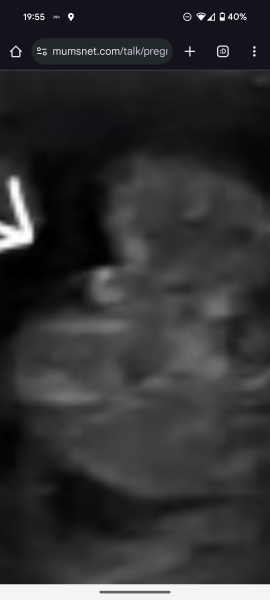 Potty shot! Boy or girl ?!