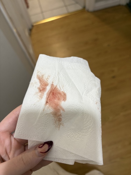 implantation or early period? TW-gross pic
