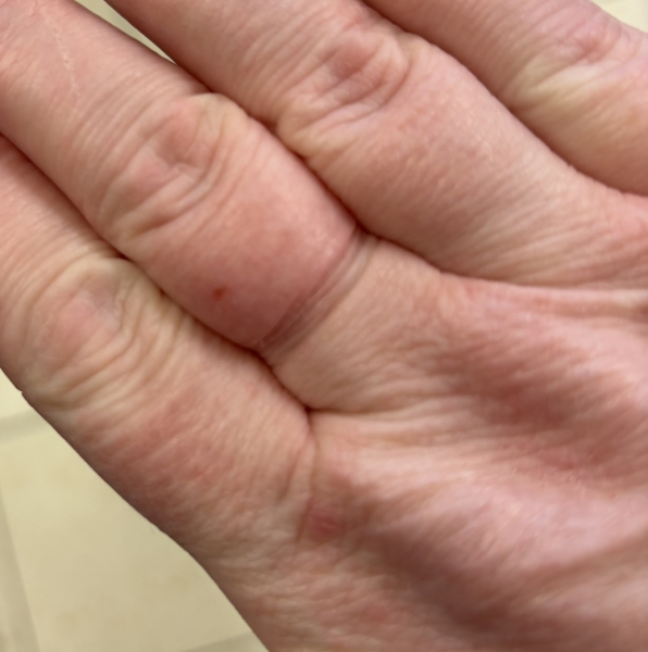 Can get ring off