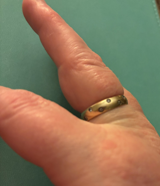Can get ring off
