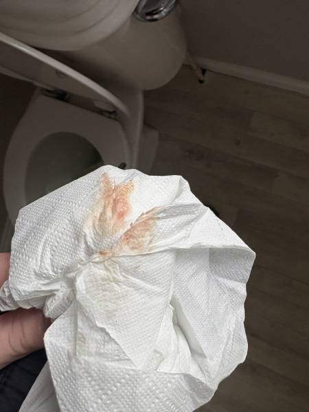 Implantation?? 10/11dpo