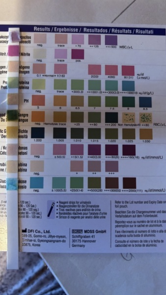 Help with reading urine test strip results (images included)